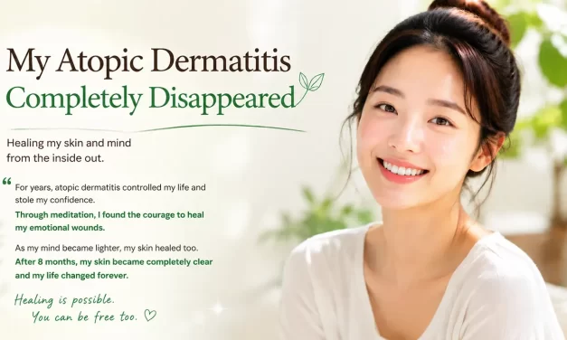🌿 “MY ATOPIC DERMATITIS COMPLETELY DISAPPEARED” | MEDITATION TESTIMONIAL | SANTA CLARA MEDITATION